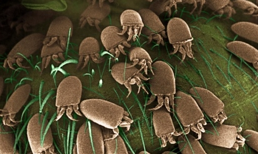 真菌荧光染色剂品牌带你认识尘螨这个常见的过敏原到底是什么样子