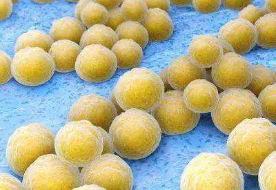 真菌荧光染色液厂家介绍金黄色葡萄球菌感染症状是什么