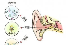 真菌荧光染色剂厂家提醒您警惕：掏耳朵竟致真菌感染！