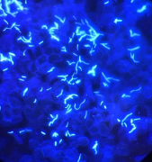 真菌荧光染色剂厂家介绍法在现代医学真菌检测中的重要地位