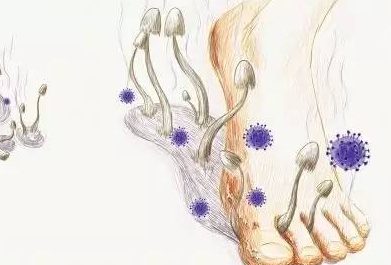 真菌荧光染色试剂厂家温馨提示冬季是祛除脚气的最佳时机