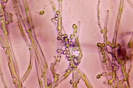 真菌染色液|真菌荧光染色液厂家带你一起了解神秘而美丽的真菌-淡紫拟青霉