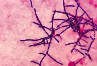 真菌荧光染色液介绍马尔尼菲篮状菌