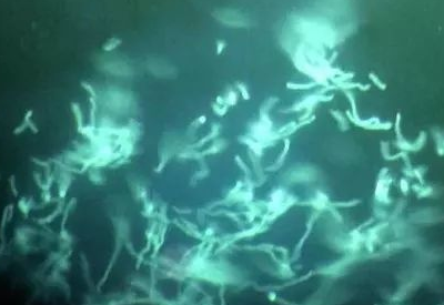真菌荧光染色液怎么用？跟真菌荧光镜检是什么关系？