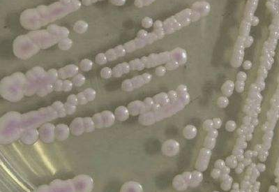 真菌染色液介绍耳道念珠菌是什么凭什么被称作超级真菌