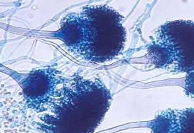 真菌染色液介绍侵袭性真菌感染