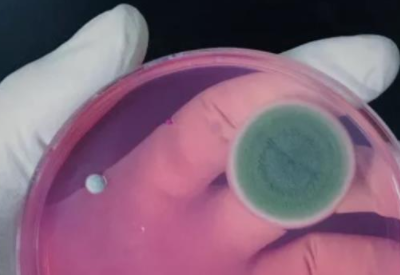 真菌染色液厂家解答为什么人体真菌感染不适合使用激素类药膏治疗