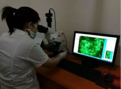真菌荧光染色液厂家帮您区分传统真菌镜检与真菌荧光染色有什么优势