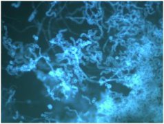 真菌染色液小课堂为您介绍真菌检测新技术-荧光染色是怎么回事？