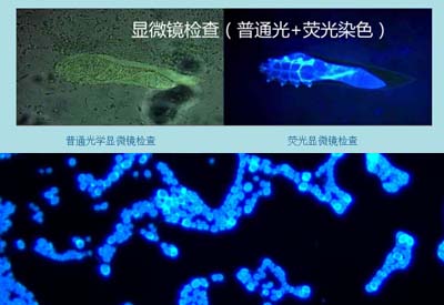 真菌染色液-染色对比
